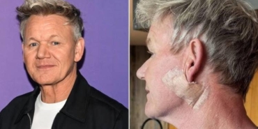 unlu-sef-gordon-ramsay-cilt-kanserine-yakalandi-BGRJQDVx.jpg
