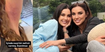 dilan-polat-sila-dogudan-siddet-gordugunu-acikladi-benim-boyle-bir-kardesim-yoktur-XpcjJHxl.jpg